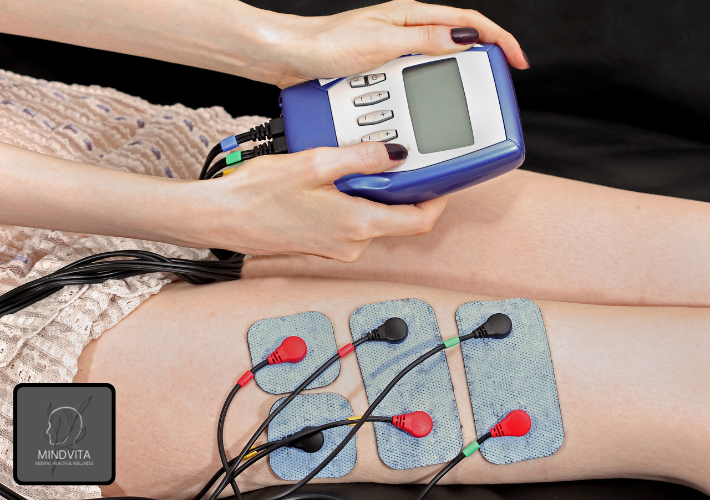 electro shock therapy a lifeline for mental health in 2026